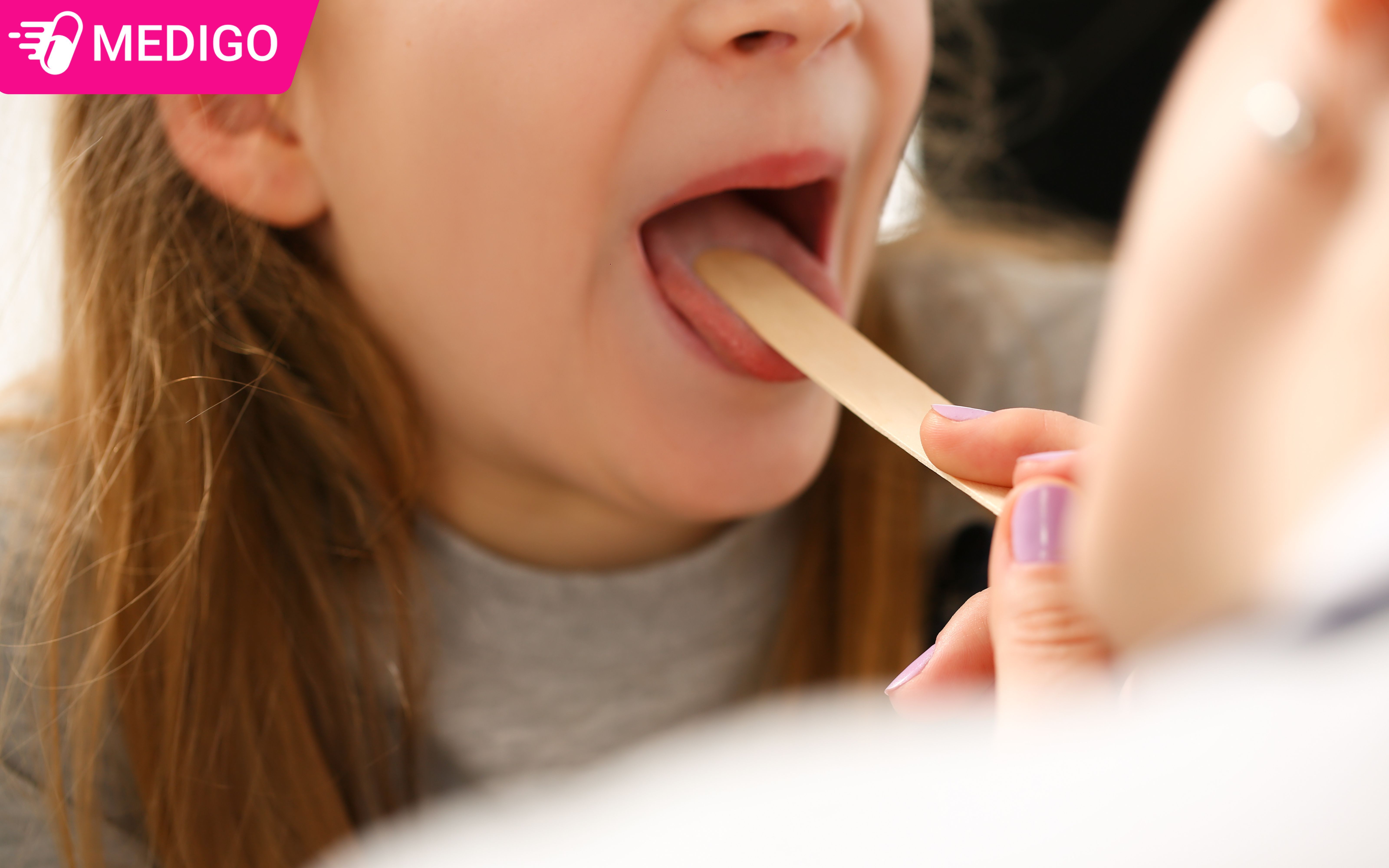 Chan-doan-viem-hong-hat