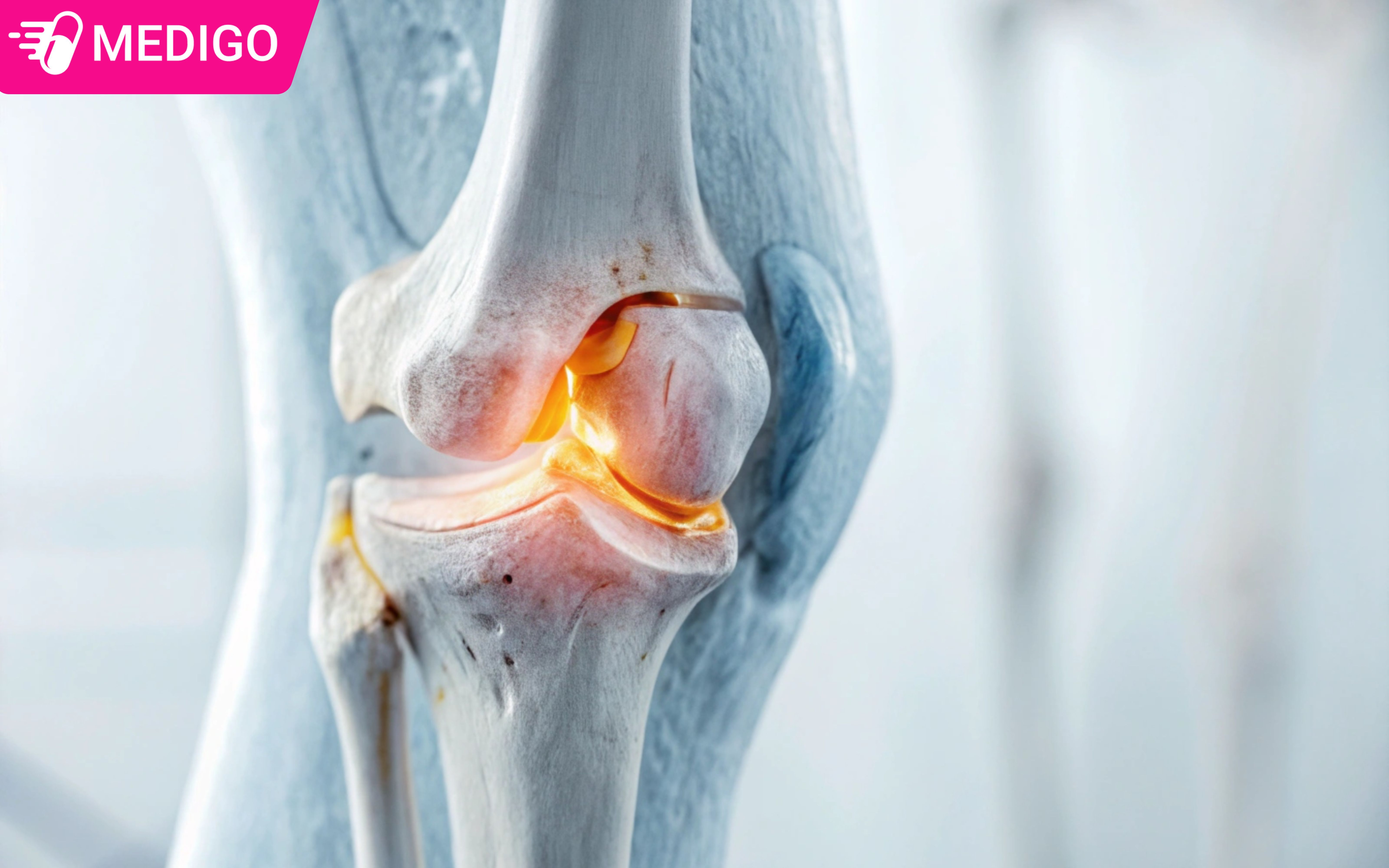 Cac-yeu-to-anh-huong-den-do-chac-khoe-cua-xuong