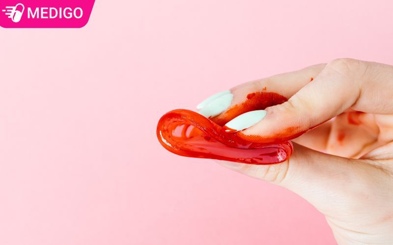 Ra máu sau quan hệ có nguy hiểm không? Khi nào cần đi khám?