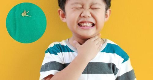 Cách chữa hóc xương cá nhanh, an toàn tại nhà