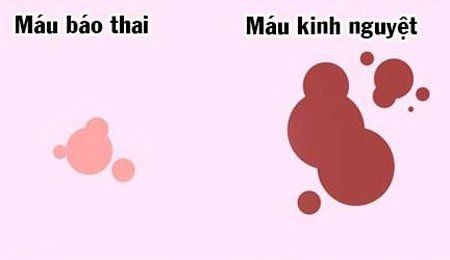 Máu báo thai là gì? Dấu hiệu nhận biết máu báo thai với kỳ kinh nguyệt