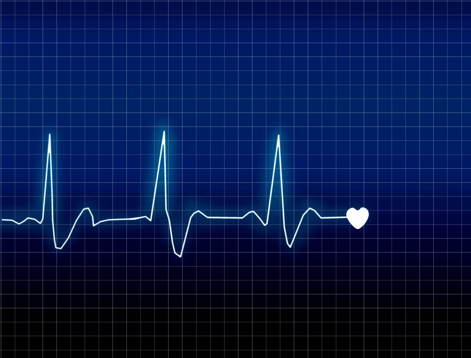 Nhịp tim của người bình thường là bao nhiêu?