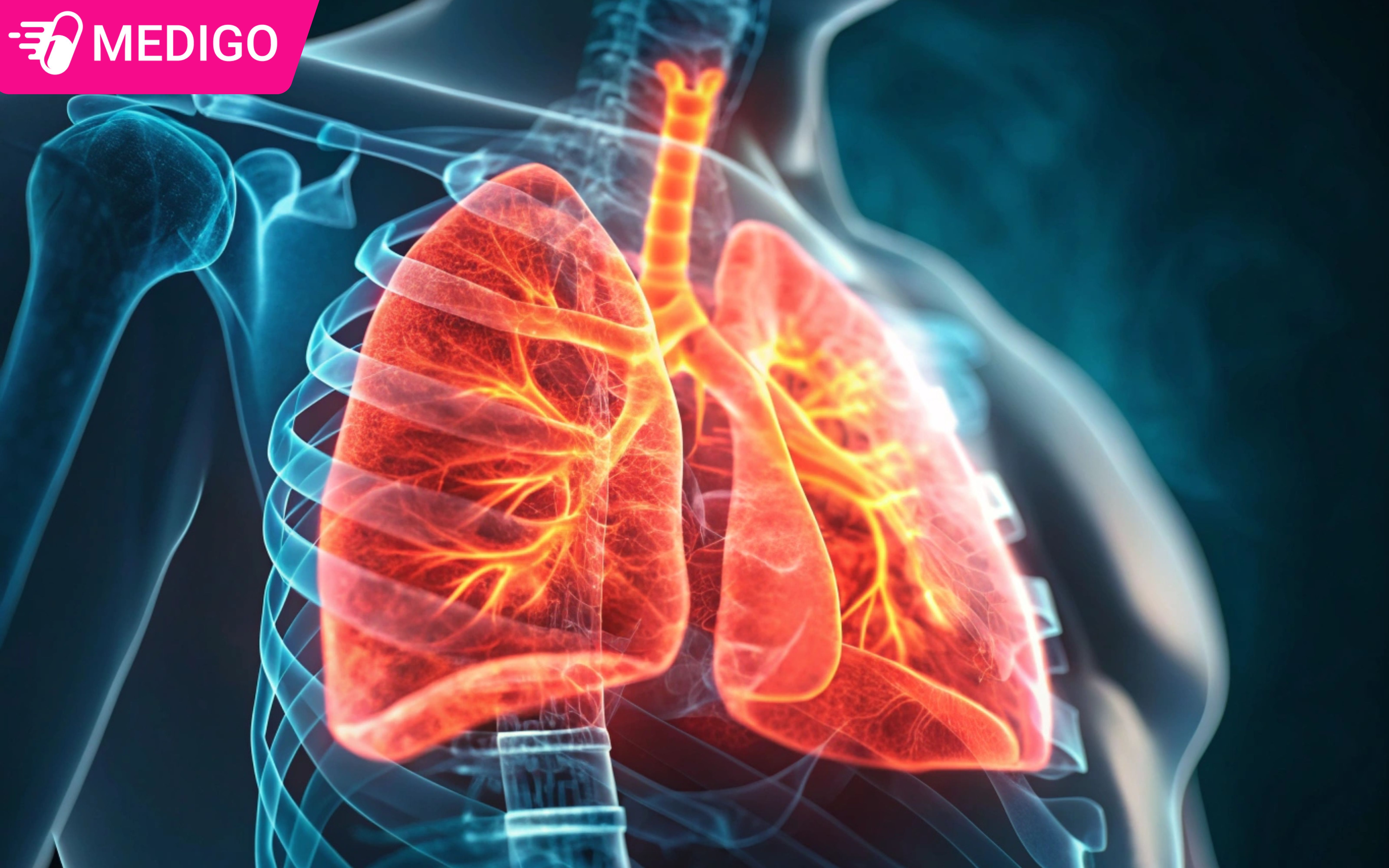 Bệnh phổi: Dấu hiệu nhận biết, nguyên nhân, các bệnh thường gặp và cách phòng ngừa