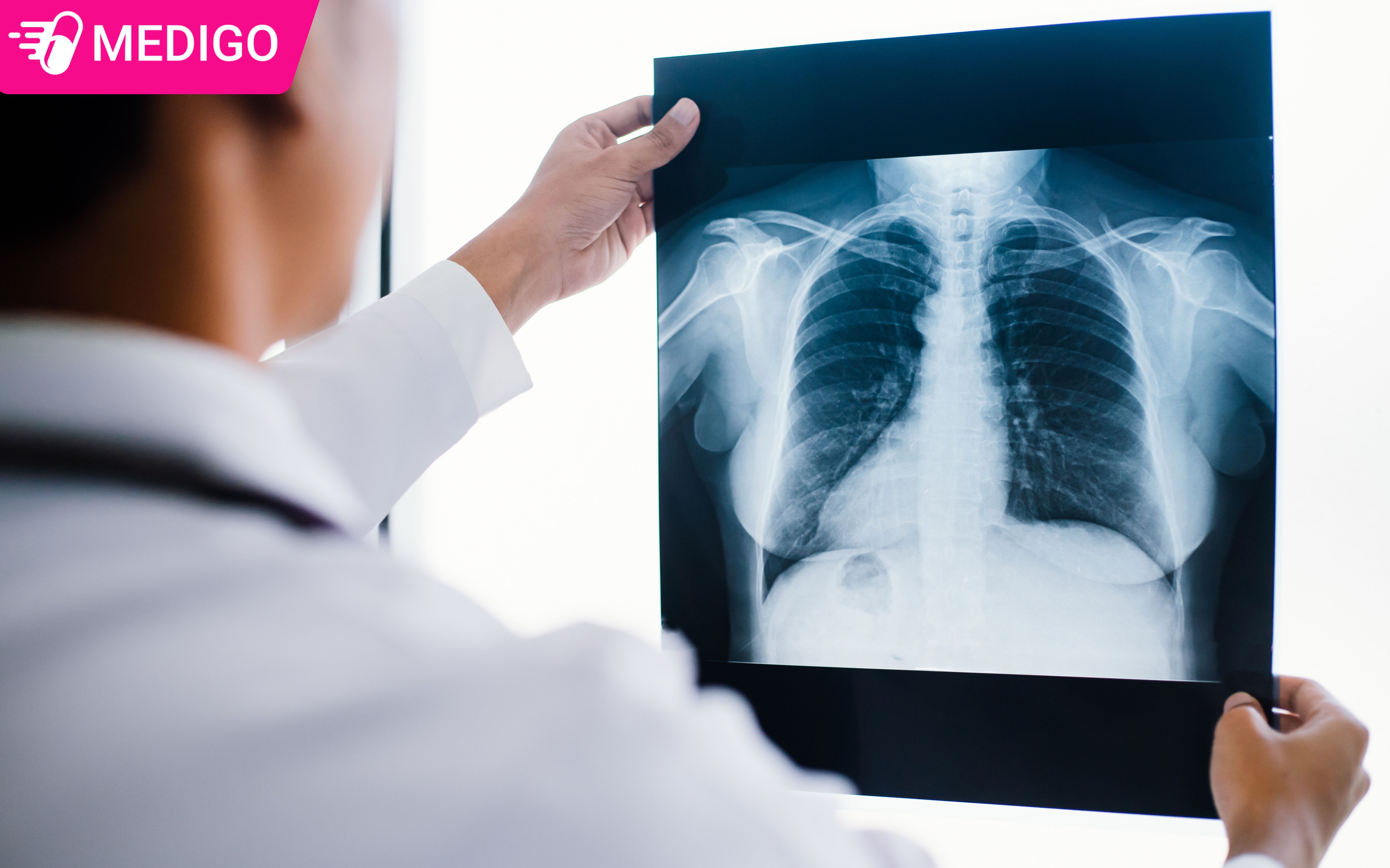 Chup-X-quang-nguc-de-chan-doan-benh-phoi