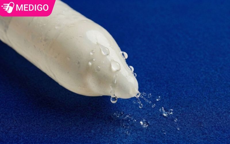 Rách bao cao su có cần xét nghiệm HIV không? Giải đáp chi tiết