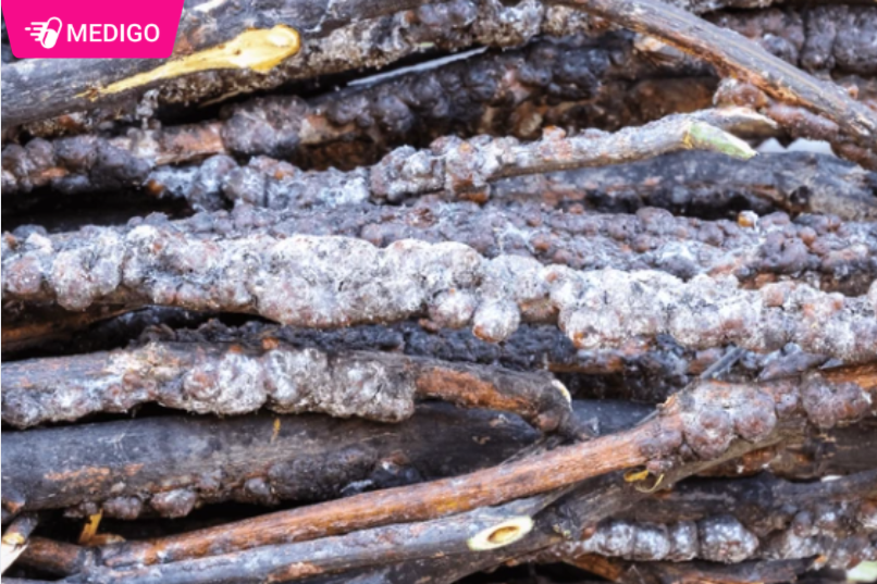 Cac-thanh-phan-cua-Canh-kien-do