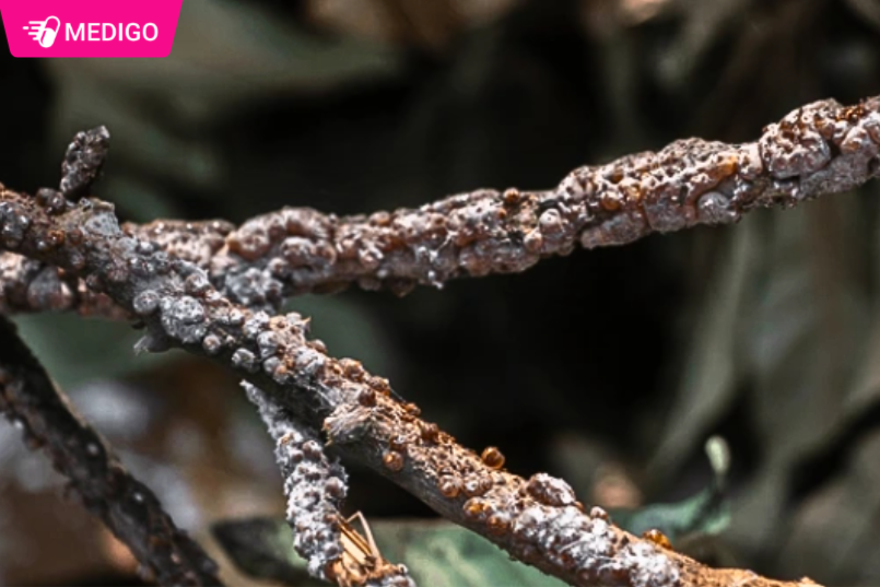 Nguon-goc-cua-Canh-kien-do