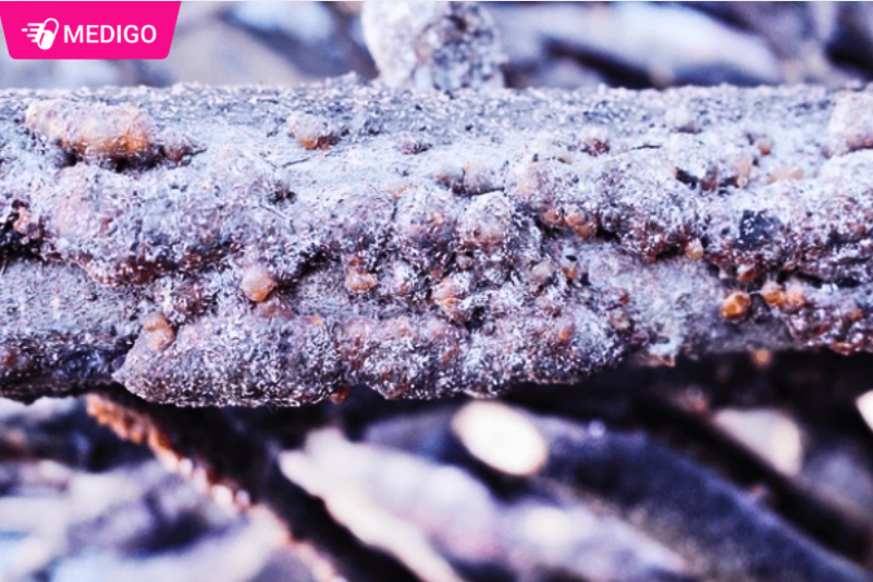 Cong-dung-chinh-cua-Canh-kien-do