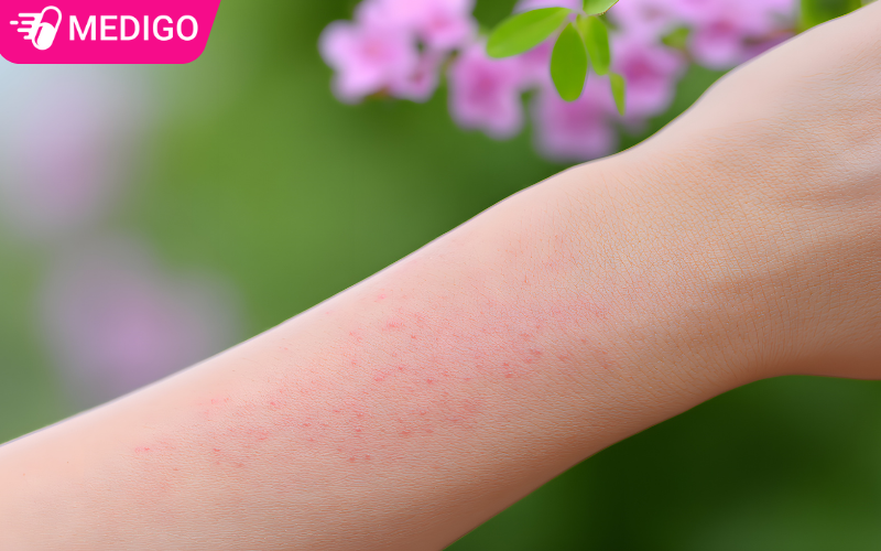 Man-do-co-the-la-tac-dung-phu-khi-su-dung-thuoc