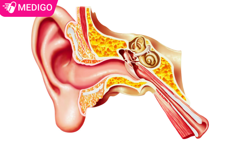 Tai-chay-mu-co-the-la-viem-tai-giua