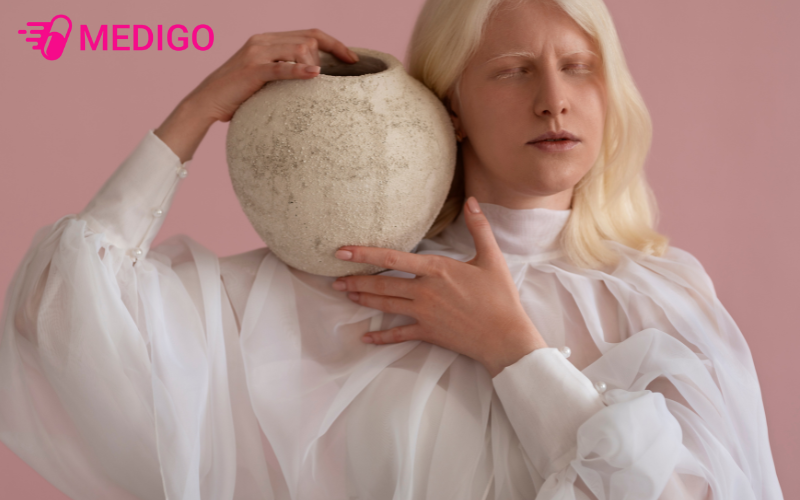 Benh-bach-tang-la-mot-roi-loan-di-truyen-hiem-gap-do-co-the-thieu-hut-melanin