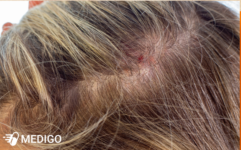 Bieu-hien-nang-hon-cua-nam-da-dau