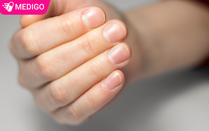 Cham-soc-mong-dung-cach-de-ngua-nam-mong-tai-phat