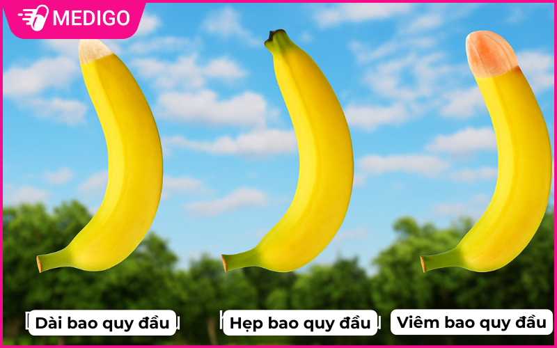 Chi-dinh-y-te-quan-trong-khi-cat-bao-quy-dau