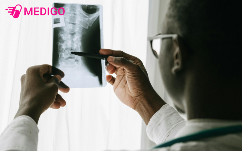 Chup-X-quang-nguc-co-the-phat-hien-khoi-u-nhung-kho-phat-hien-som