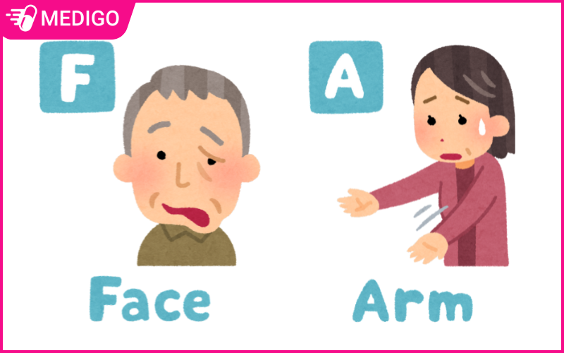 Co-the-nhan-dien-dau-hieu-tai-bien-qua-mat-va-tay