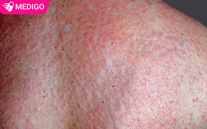 Thuoc-co-cong-dung-dieu-tri-cac-benh-viem-da