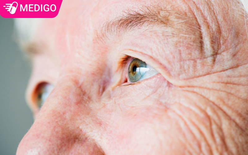 Đục thủy tinh thể: Khi nào cần phẫu thuật?