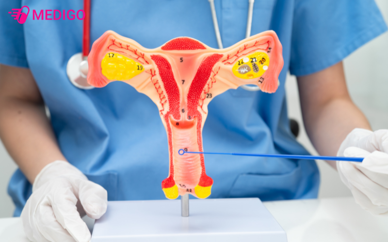 Dung-dich-ve-sinh-phu-nu-giup-ho-tro-phong-ngua-viem-nhiem 