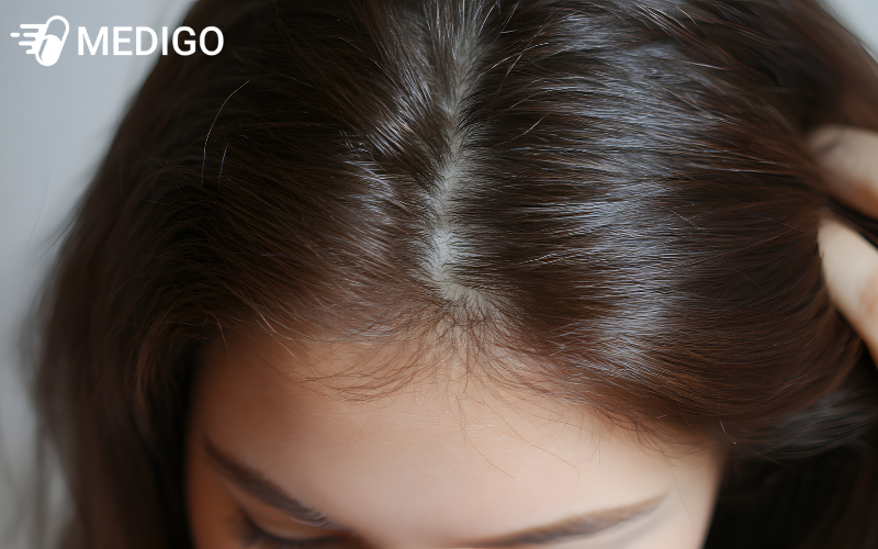 Goi-dau-bang-duoc-lieu-tu-nhien-co-the-giup-cai-thien-tinh-trang-nam-da-dau