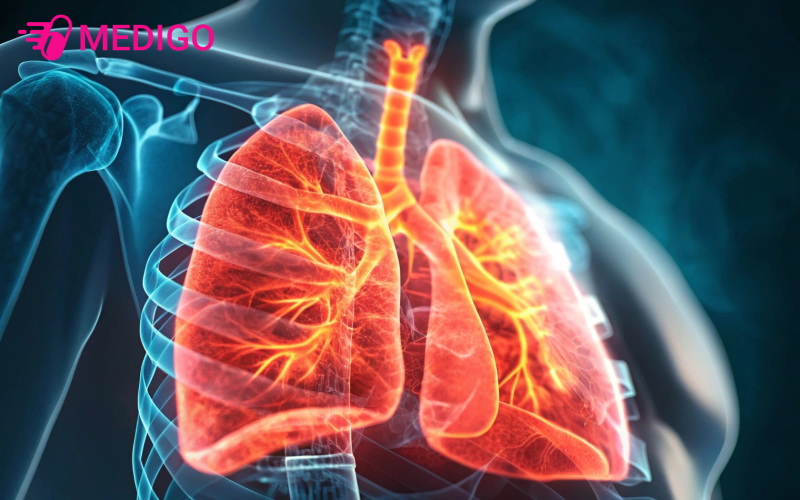 Khi-co-the-tich-luy-mo-qua-muc-ganh-nang-len-he-ho-hap-ngay-cang-tang-cao