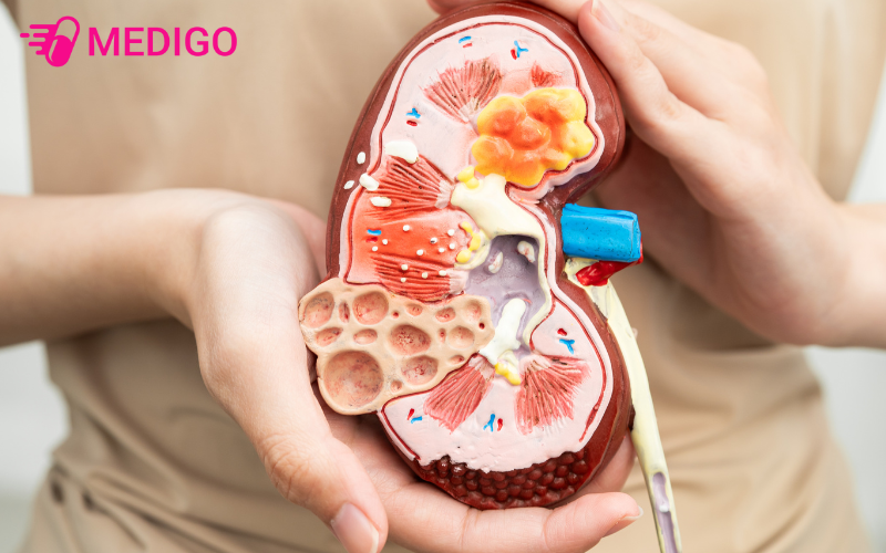 Kiem-soat-can-nang-lam-giam-nguy-co-mac-cac-benh-man-tinh