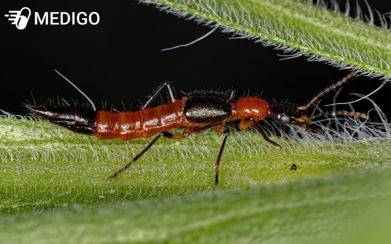 Kiến ba khoang cắn: Cách nhận biết, xử trí và phòng tránh hiệu quả