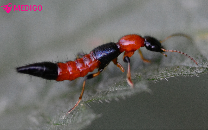 Kien-ba-khoang-co-mau-den-va-do-xen-ke-tao-thanh-3-khoang-ro-ret