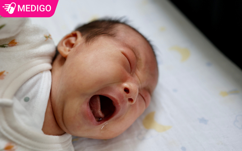 Trẻ em co giật: Nguyên nhân, dấu hiệu và cách xử lý đúng để bảo vệ trẻ