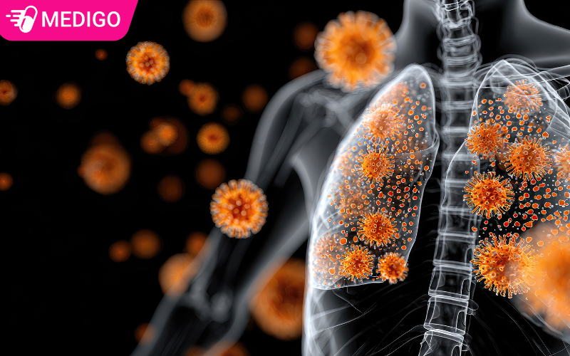 Virus RSV là gì? Dấu hiệu nhận biết và cách bảo vệ trẻ nhỏ