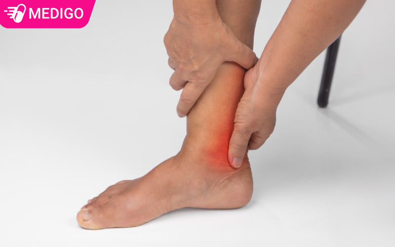 Nhận biết Gout qua những dấu hiệu nào? Cảnh báo sớm bệnh Gout phổ biến