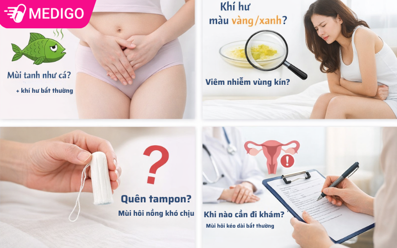 Phụ khoa: Em bé có mùi hôi do đâu? 10 nguyên nhân thường gặp & cách xử lý