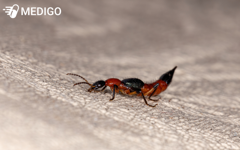 Ly-do-vi-sao-con-nguoi-de-tiep-xuc-voi-kien-ba-khoang