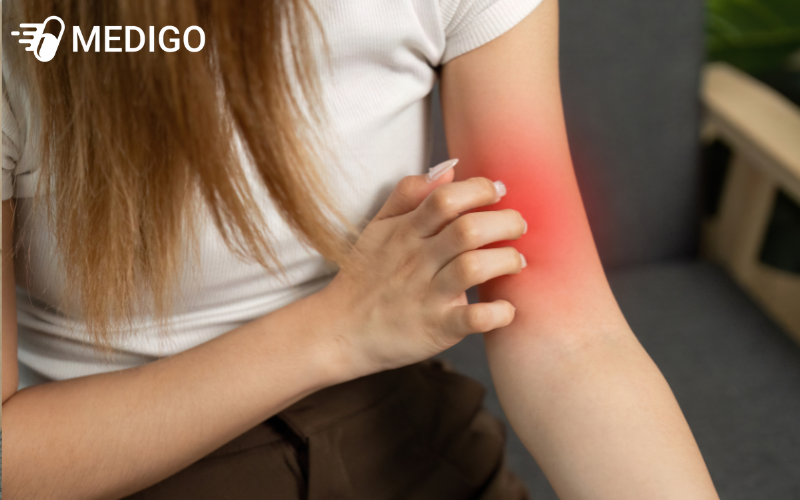 Neu-dung-sai-cach-La-trau-co-the-gay-kich-ung-da-va-niem-mac