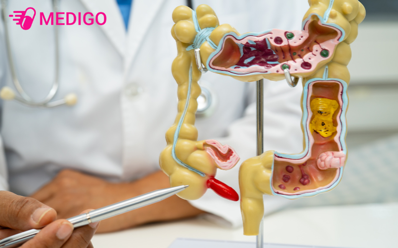 Ruot-thua-la-mot-tui-nho-dang-ong-dai-khoang-3-13cm