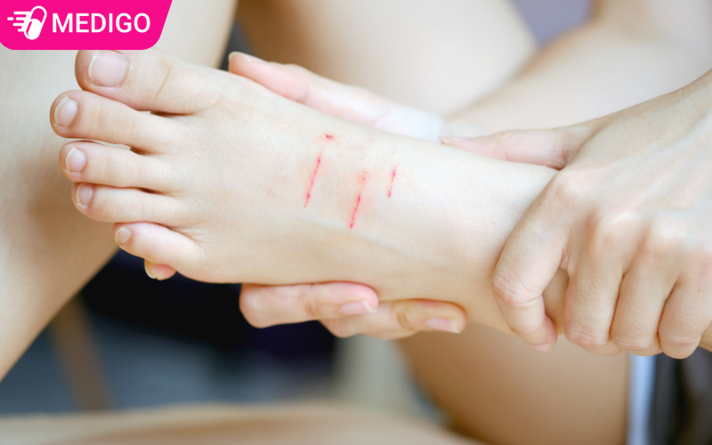 Sau-khi-bi-cho-can-so-cuu-va-nhanh-chong-den-co-so-y-te-tiem-phong