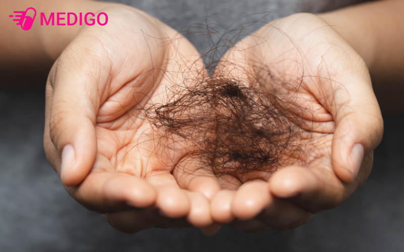 Sau-khi-sinh-con-me-bim-phai-trai-qua-tinh-trang-rung-toc