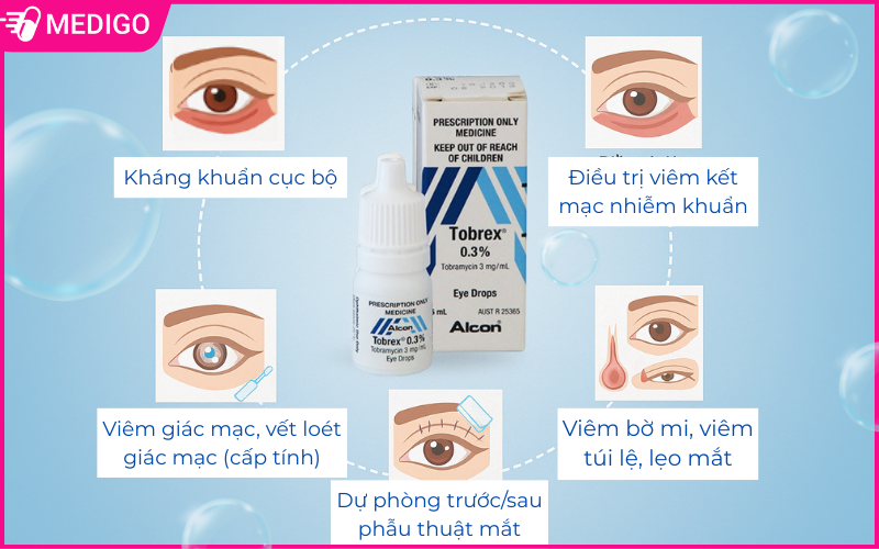 Tac-dung-cua-thuoc-nho-mat-Tobrex-trong-dieu-tri