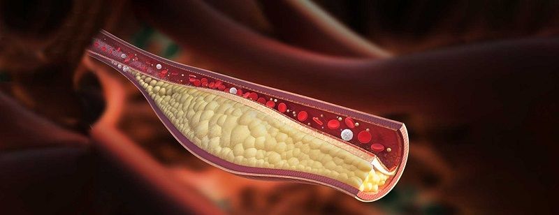 Tang-Cholesterol (1).jpg