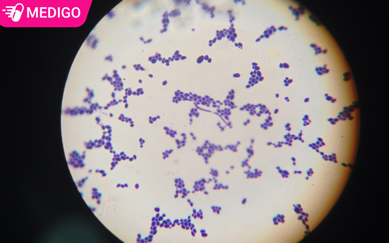 Viêm âm đạo do nấm Candida: Nguyên nhân và cách điều trị