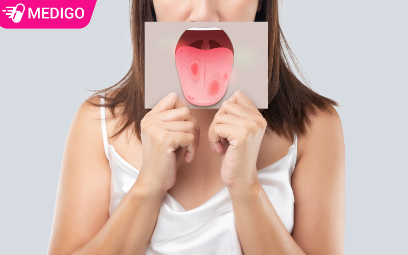 Quan hệ oral sex có lây bệnh không? 4 rủi ro không nên chủ quan