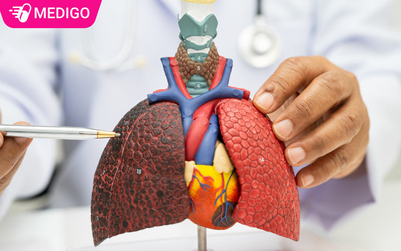 U gan lành tính có cần phẫu thuật không? 