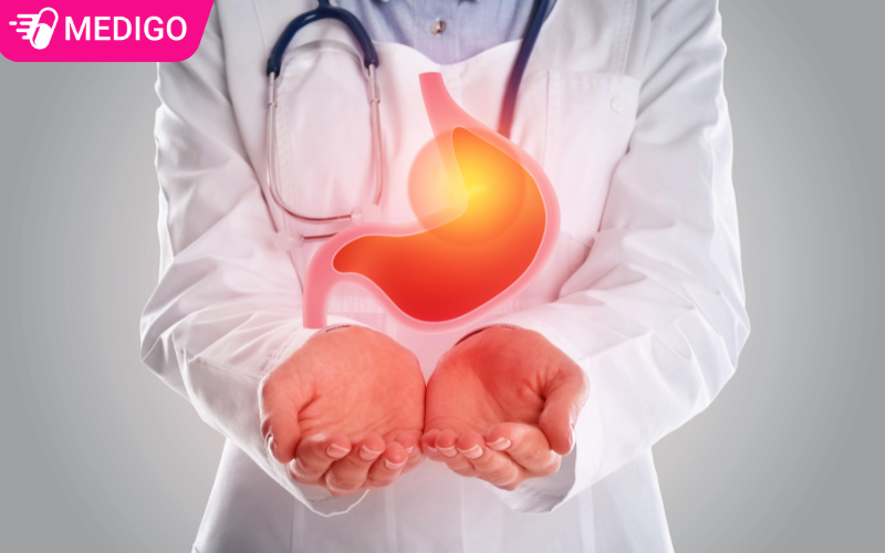 Thuốc trị loét dạ dày - 4 nhóm thuốc điều trị viêm loét dạ dày phổ biến