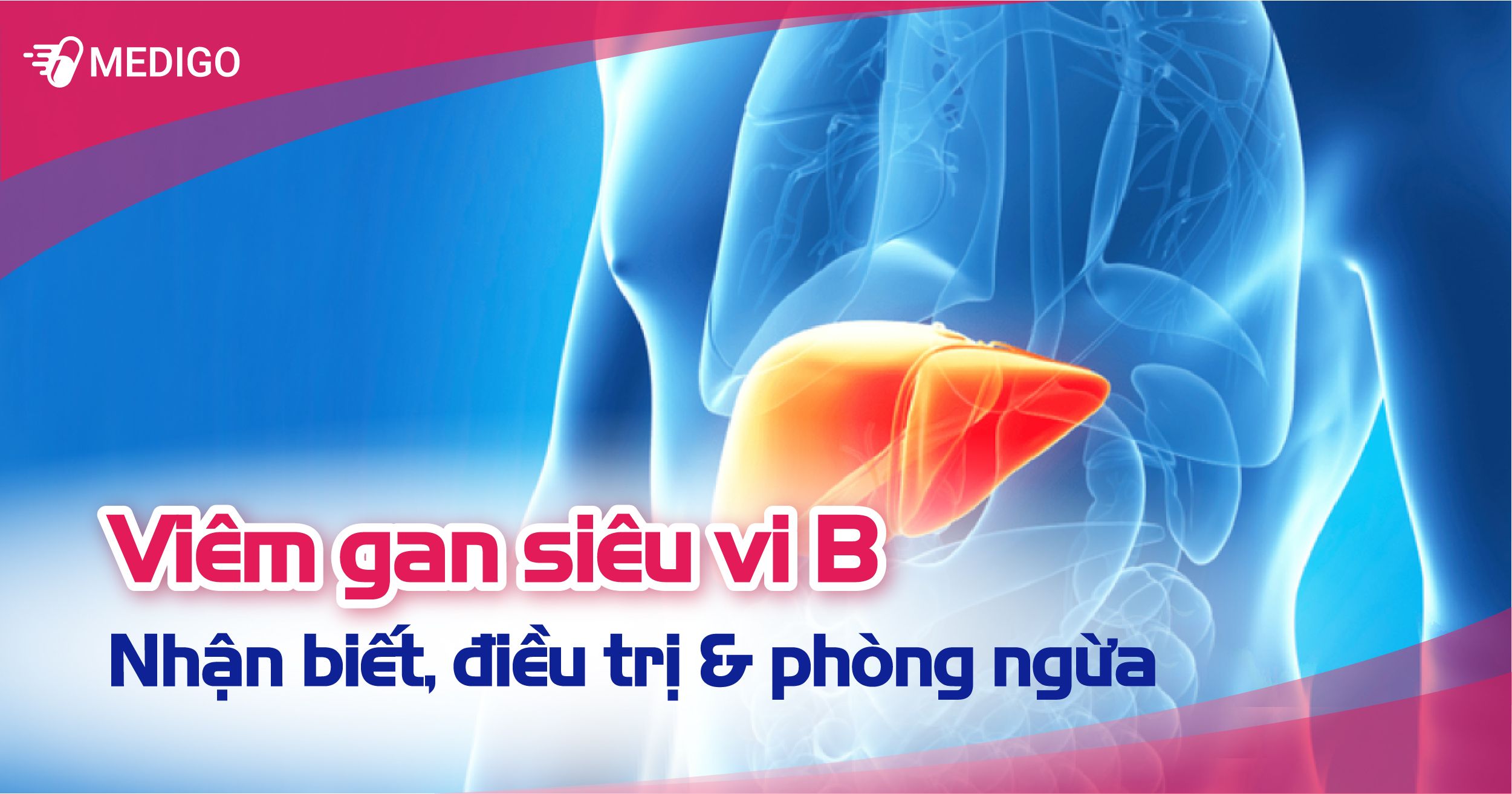 Viêm gan B: Nguyên nhân, triệu chứng, chuẩn đoán và điều trị