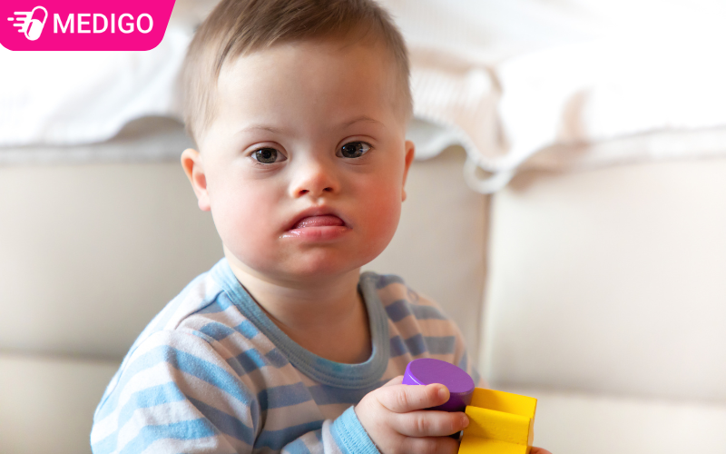 benh-down-co-the-anh-huong-den-qua-trinh-phat-trien-cua-co-the-va-nao-bo