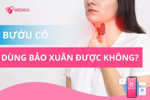 Giải đáp: bị bướu cổ có uống Bảo Xuân được không?