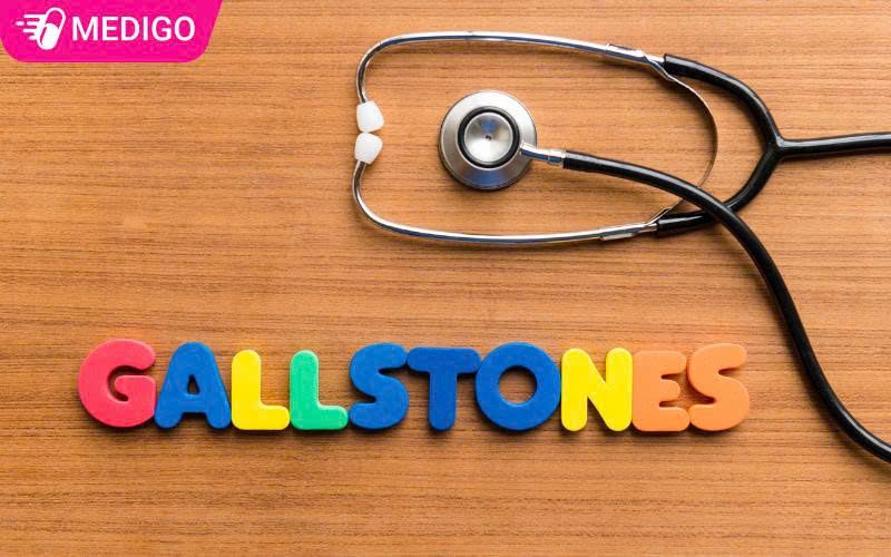 Sỏi Mật Là Gì? Nguyên Nhân, Triệu Chứng Và Cách Điều Trị Từ A-