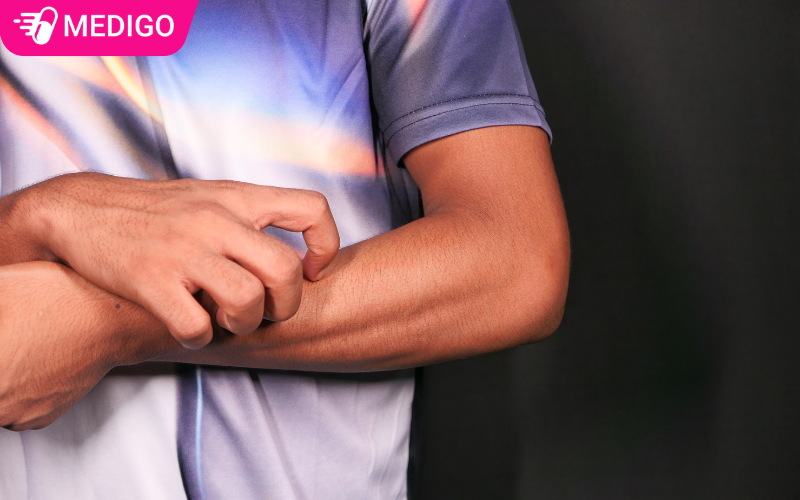 Co-the-bi-phat-ban-ngua-rat-cung-la-1-trong-nhung-trieu-chung-cua-benh-sot-xuat-huyet