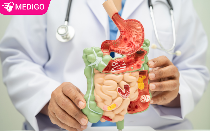 luu-y–ve-cac-thoi-diem-can-su-dung-vien-uong-ho-tro-tieu-hoa