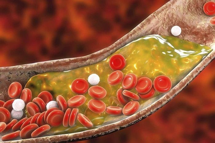 cholesterol